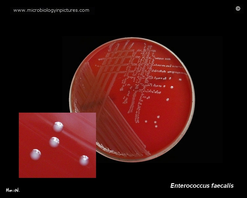 Enterococcus faecalis on blood agar Enterococcus faecalis growing in pure culture on blood agar